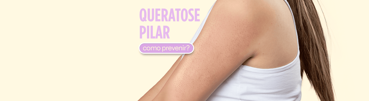 Queratose Pilar: Pode Deixar Manchas na Pele?